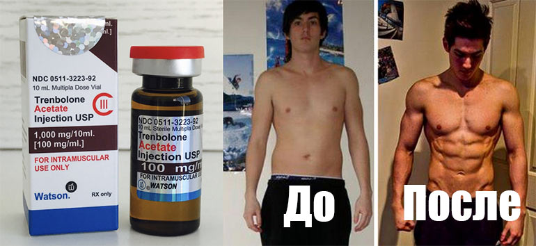 Мужчина пьет гормоны. Тренболон до и после. Гормоны роста для мышц. Анаболические стероиды в бодибилдинге.